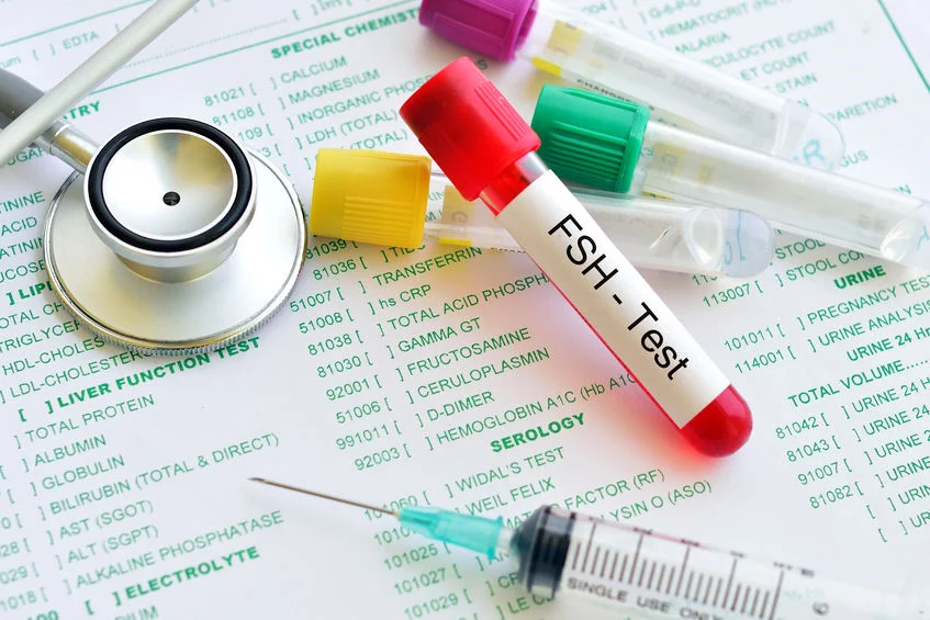 Blood sample tube labeled “FSH Test” placed on medical test reports with a stethoscope and syringe nearby.